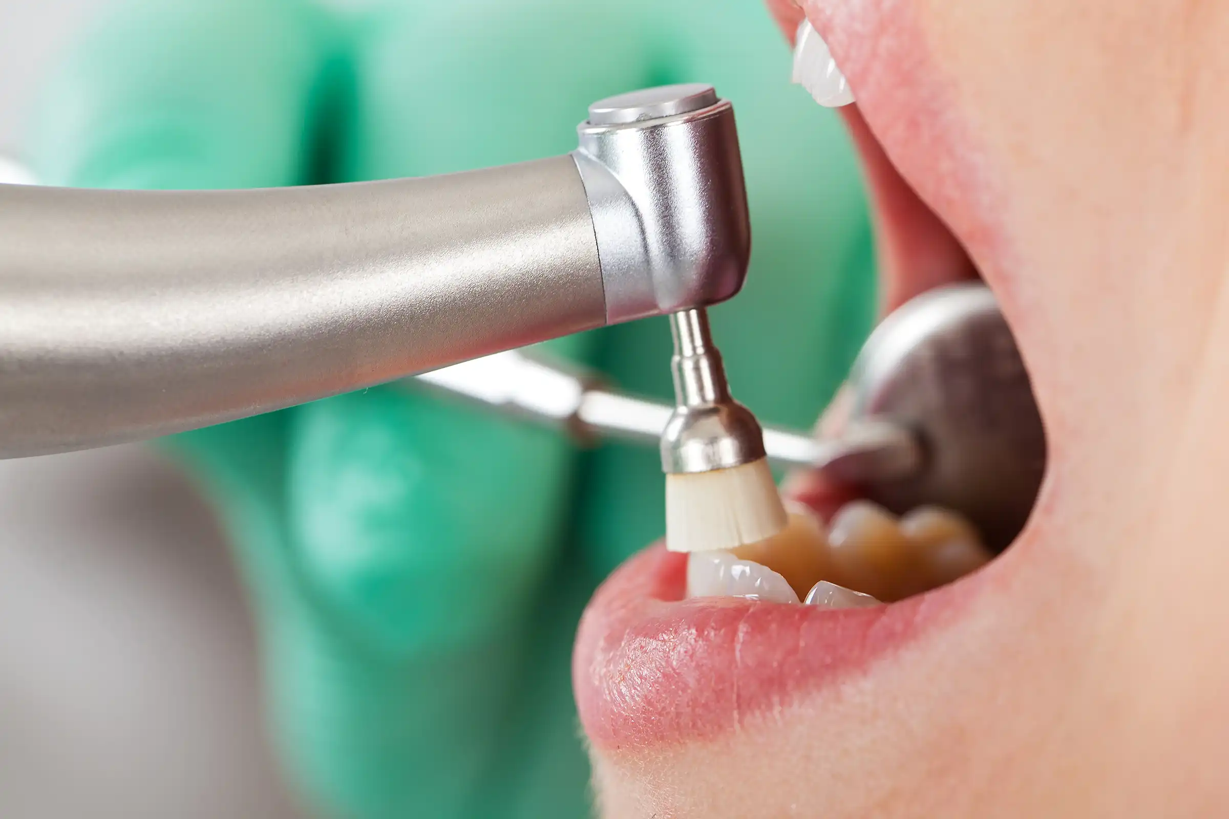 Hygienist Services